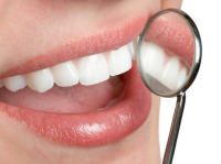 cavities