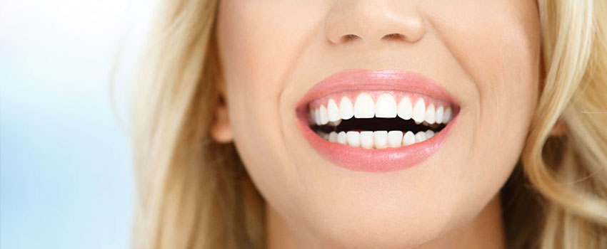dental crowns and bridges