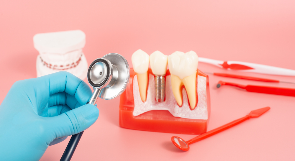 how long is the recovery time after dental implants